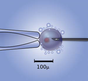 Microinjection_of_a_human_egg.svg